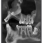     Rayscan α 3D 90x90 Ceph